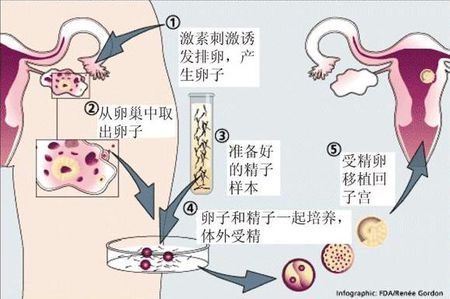 拉拉供卵服务微信群